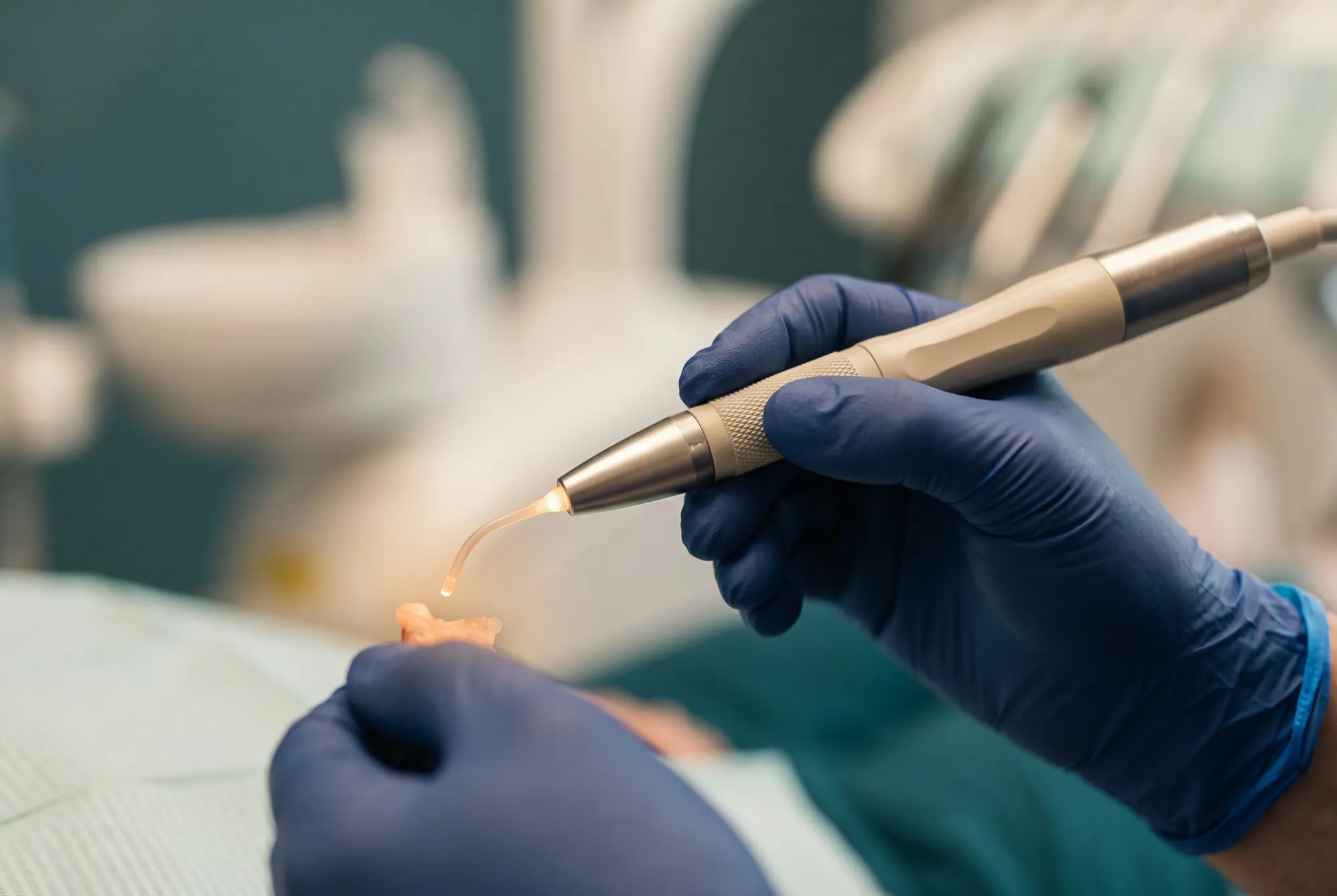 Piesă de mână laser dentar cu vârful aprins, în timpul unei intervenții